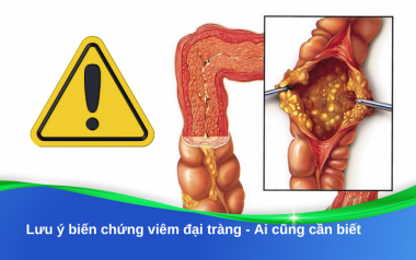 Lưu ý biến chứng viêm đại tràng - Ai cũng cần biết