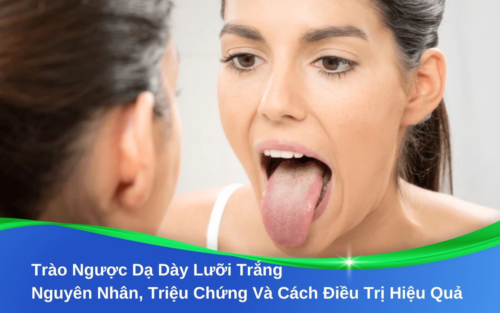 Trào Ngược Dạ Dày Lưỡi Trắng Nguyên Nhân, Triệu Chứng Và Cách Điều Trị Hiệu Quả