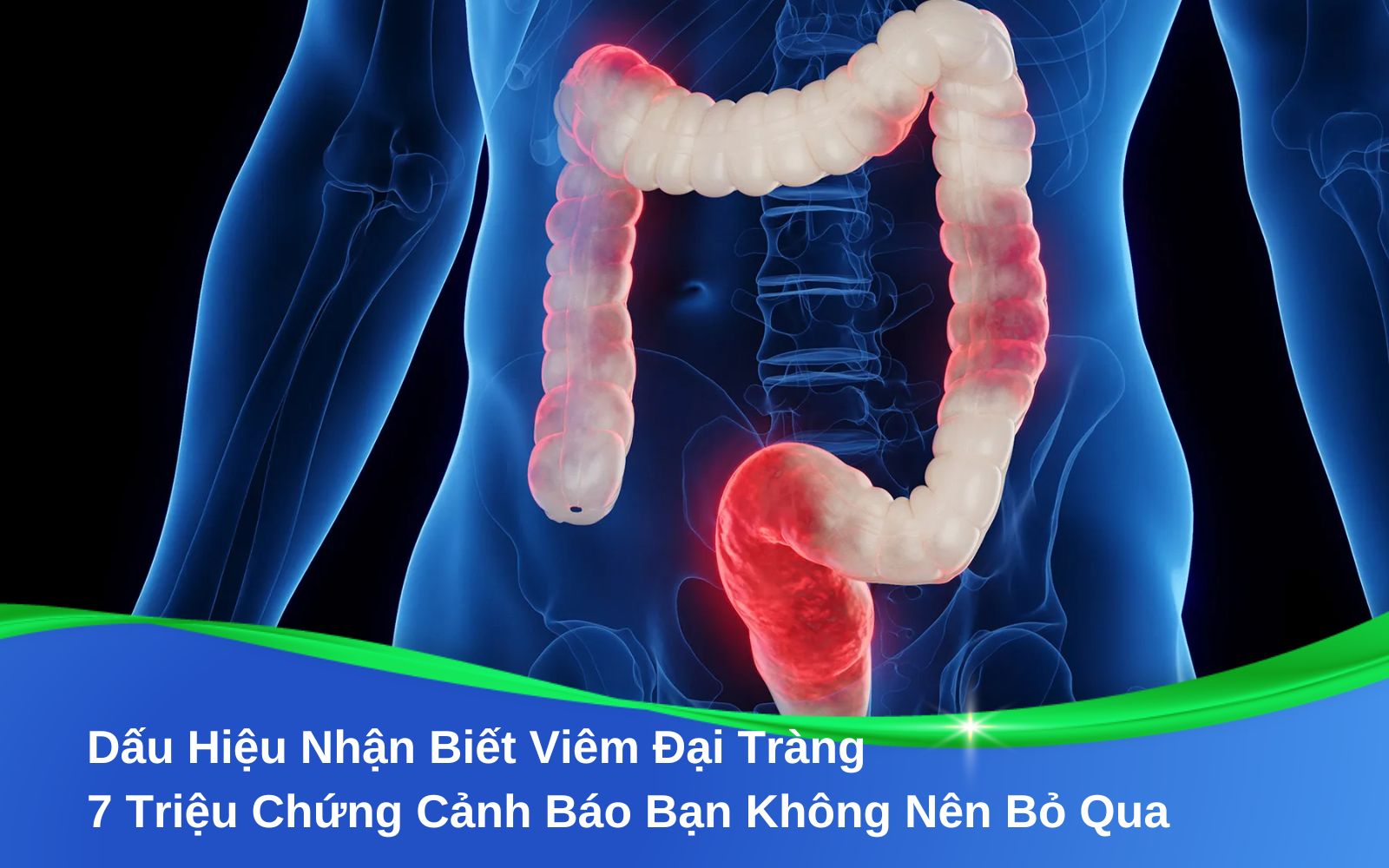 Dấu Hiệu Nhận Biết Viêm Đại Tràng 7 Triệu Chứng Cảnh Báo Bạn Không Nên Bỏ Qua
