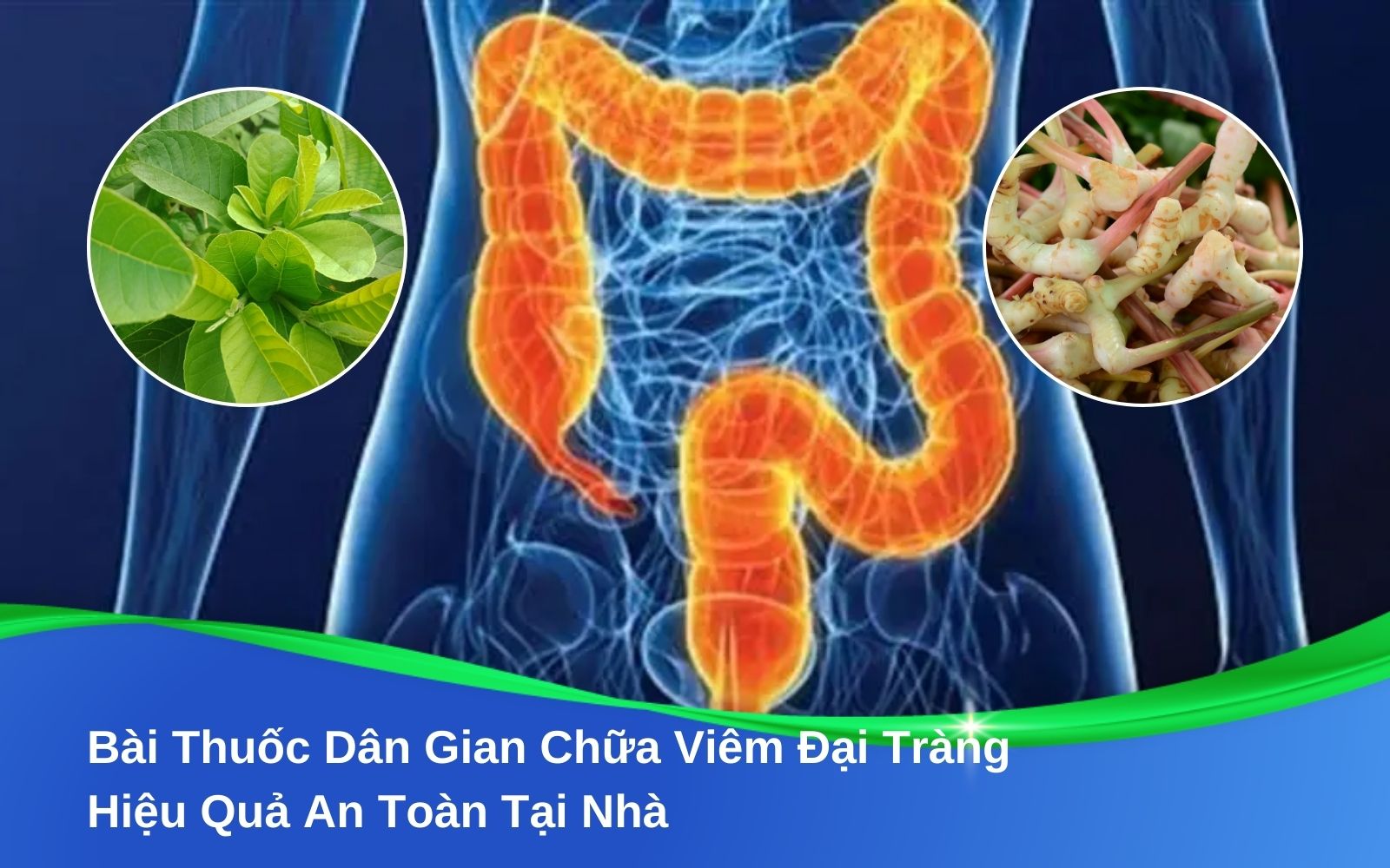 Bài Thuốc Dân Gian Chữa Viêm Đại Tràng Hiệu Quả An Toàn Tại Nhà
