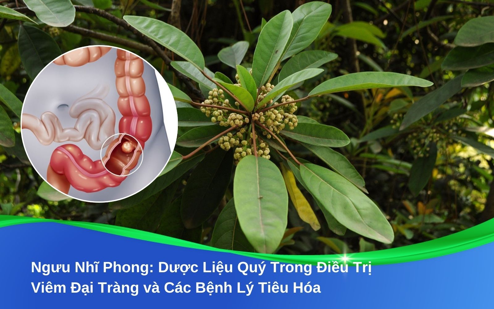 Ngưu Nhĩ Phong Dược Liệu Quý Trong Điều Trị Viêm Đại Tràng và Các Bệnh Lý Tiêu Hóa