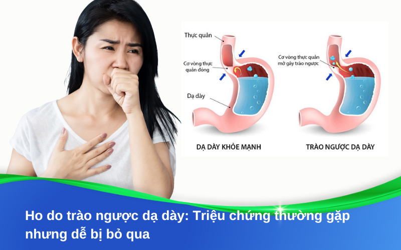 Ho do trào ngược dạ dày: Triệu chứng thường gặp nhưng dễ bị bỏ qua