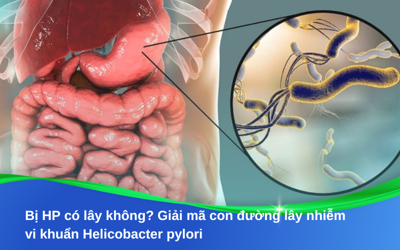 Bị HP có lây không? Giải mã con đường lây nhiễm vi khuẩn Helicobacter pylori