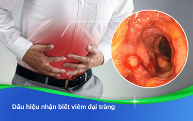 Dấu hiệu nhận biết viêm đại tràng: Phân tích khoa học để phát hiện sớm và điều trị kịp thời