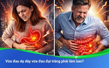 Vừa đau dạ d&agrave;y vừa đau đại tr&agrave;ng: Nguy&ecirc;n nh&acirc;n, Triệu chứng v&agrave; C&aacute;ch điều trị